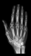 X-ray Scanner Prank Screenshot4