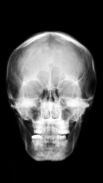 X-ray Scanner Prank Screenshot2