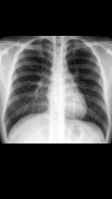 X-ray Scanner Prank Screenshot6