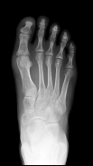 X-ray Scanner Prank Screenshot5